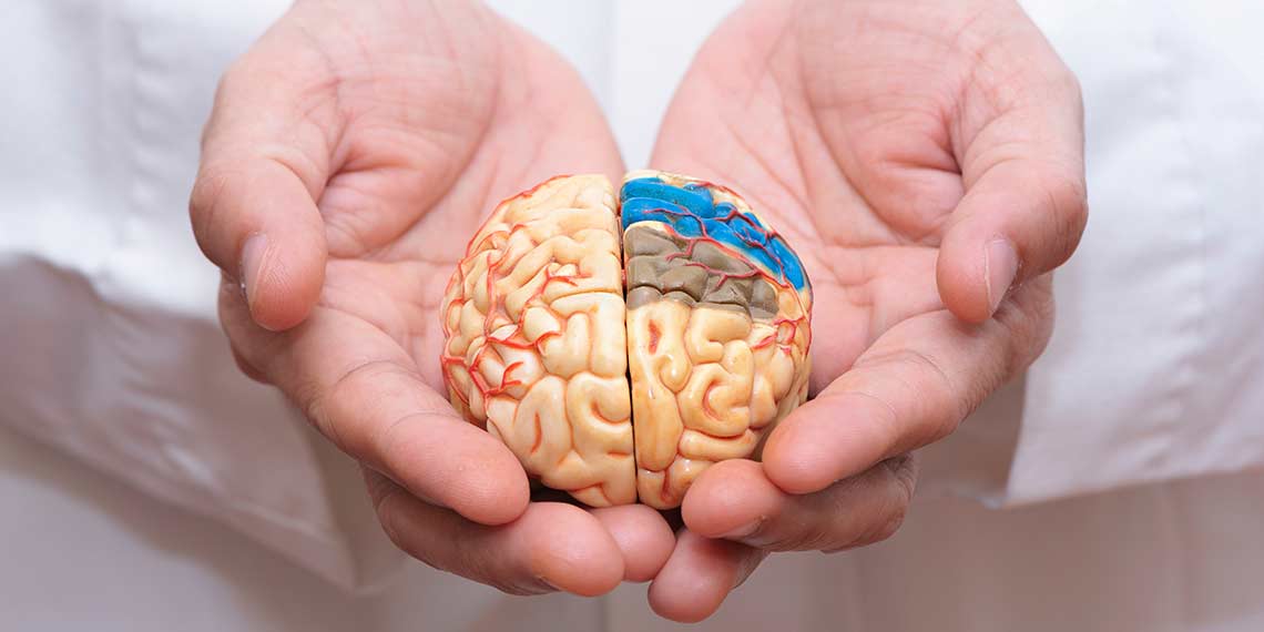 Arzt hält Gehirn-Modell in beiden Händen